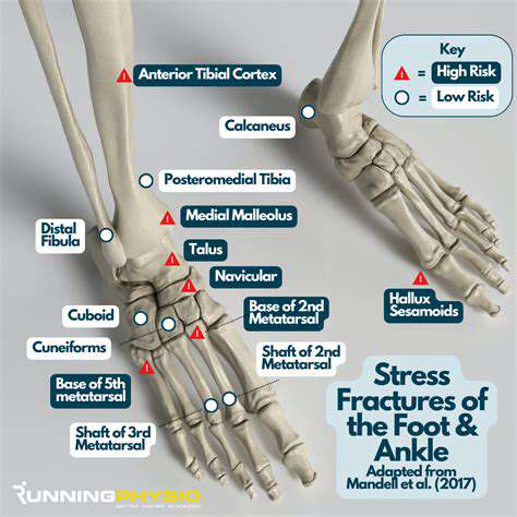 CalciumIntakeandStressFractureRisk