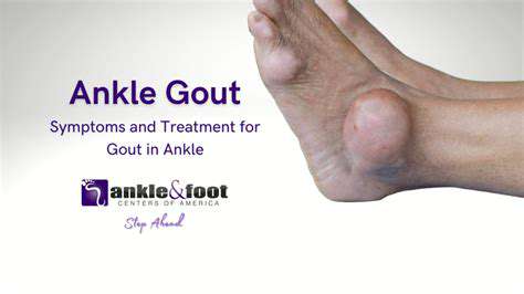 Managing Gout Attacks in the Foot​