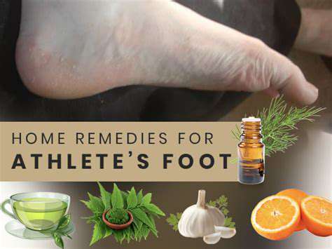 NaturalRemediesforAthlete'sFootRelief