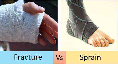 DifferentiatingBetweenSprains,Strains,andFractures