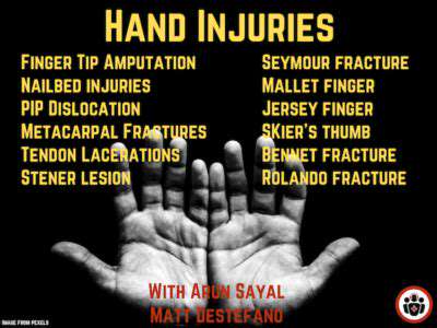 How Hands Play a Role in Aviation Safety